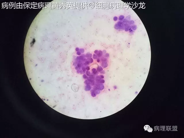 临床病理联盟-亚专科 ▪ 微信汇