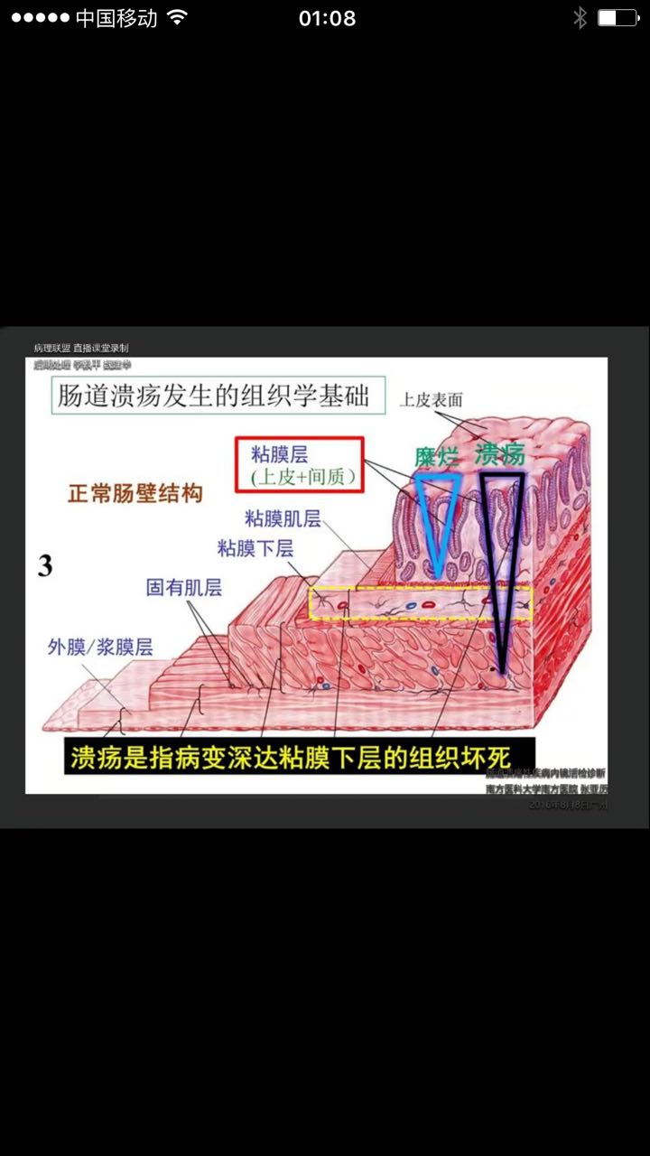 周巧灵肠脂肪垂(周周的系膜及脂肪)肯定不是浆膜,消化管的肌层外就是